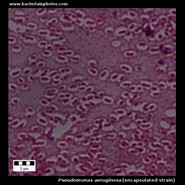 pseudomonas with capsule